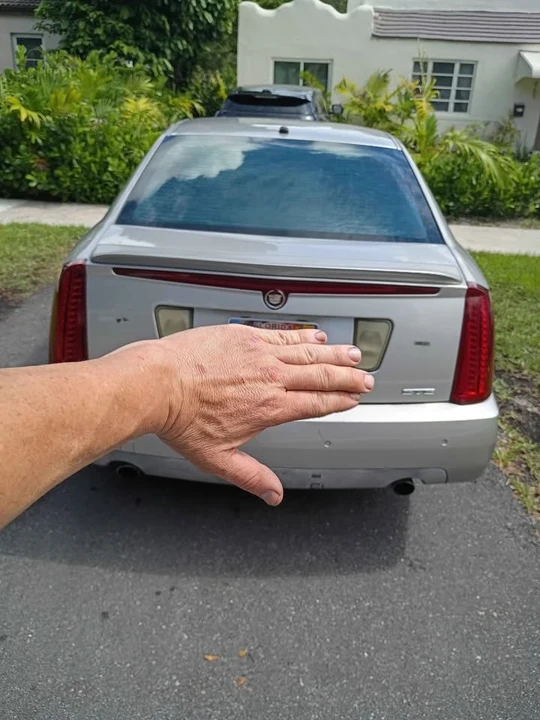 2010 Cadillac STS - Image 2 of 7