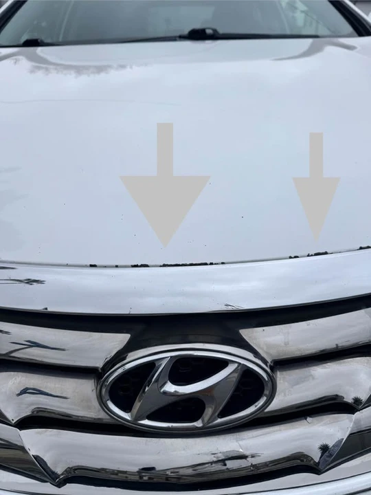 2011 Hyundai Sonata - Image 3 of 11