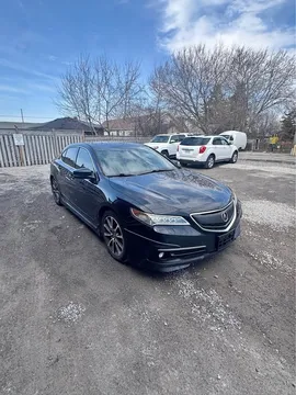 2015 Acura TLX A-Spec Elite