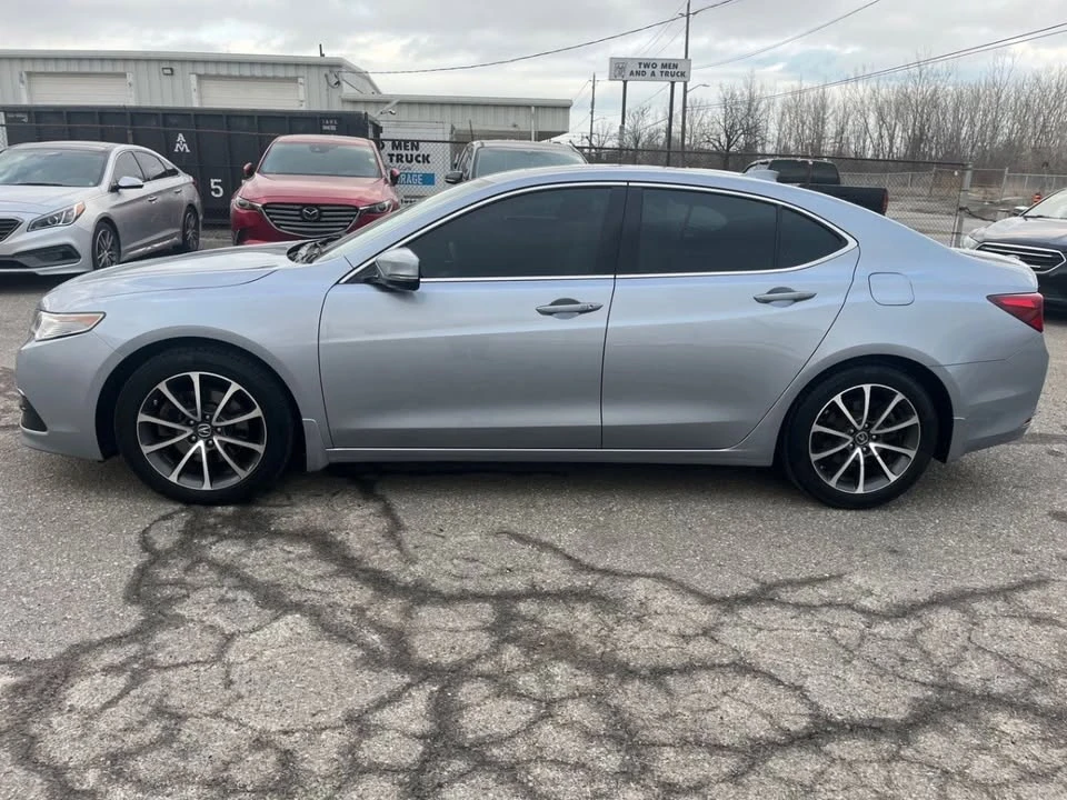 2016 Acura TLX 1st Gen - Image 2 of 5