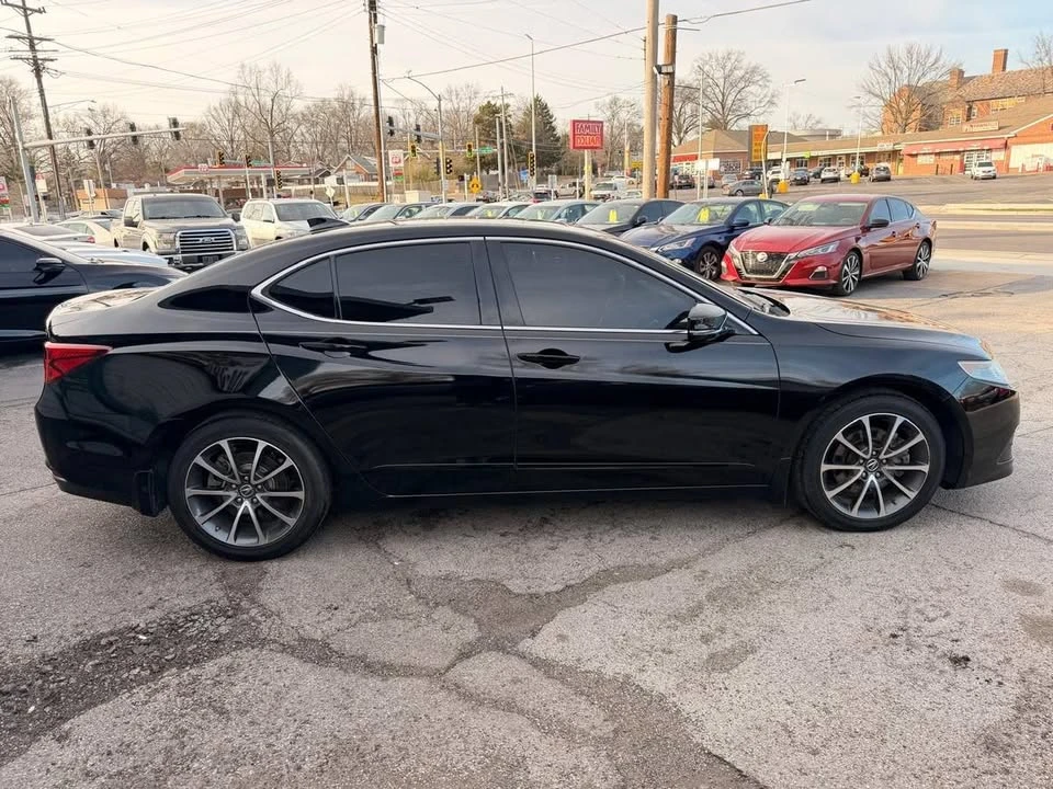 2016 Acura TLX 1st Gen - Image 4 of 20