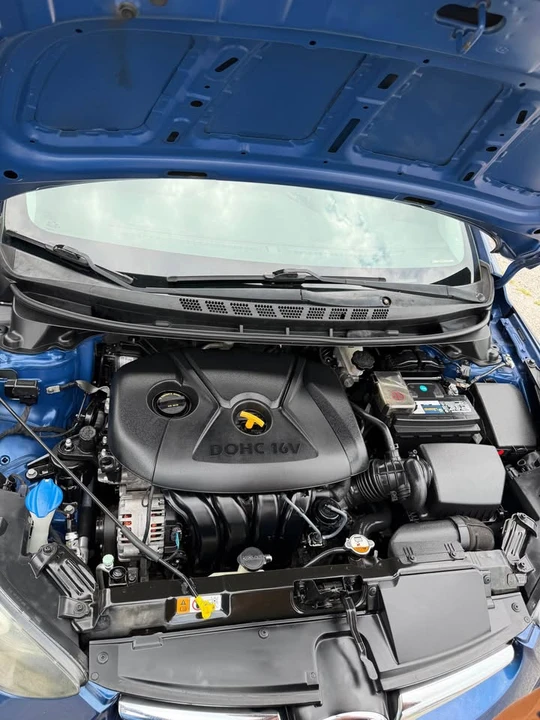 2016 Hyundai Elantra - Image 17 of 20