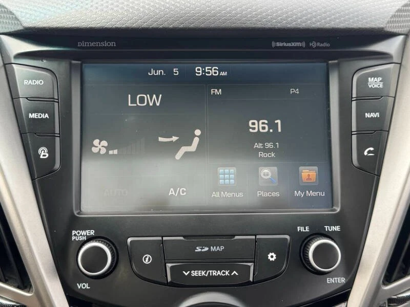 2016 Hyundai Veloster - Image 16 of 19