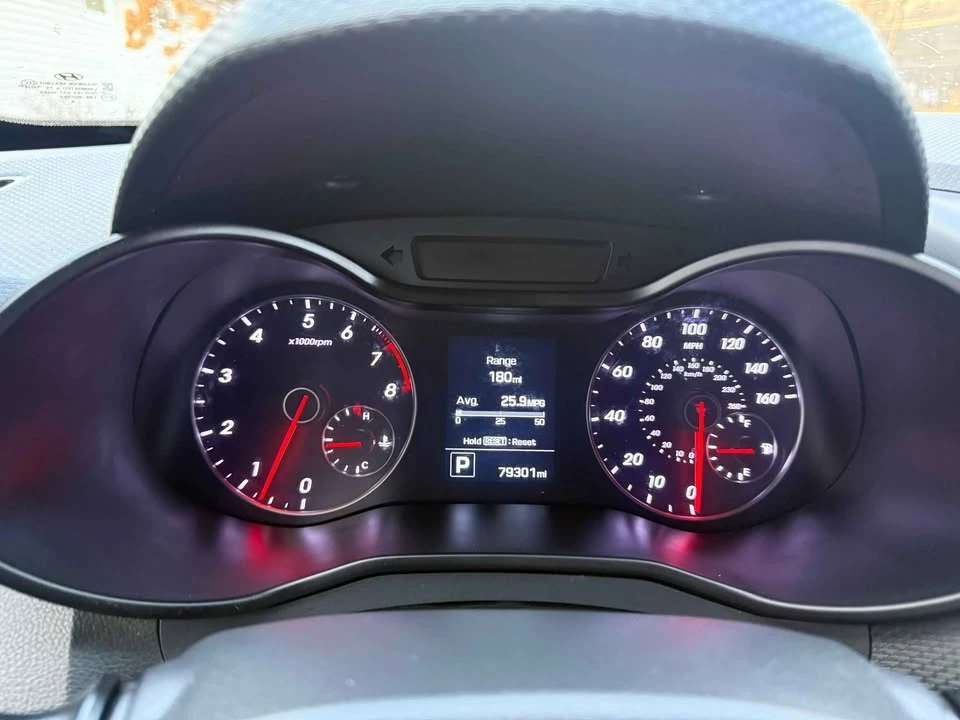 2016 Hyundai Veloster - Image 17 of 18