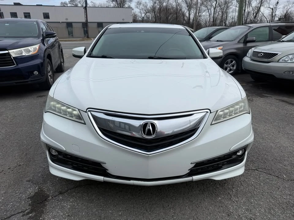 2017 Acura TLX 1st Gen - Image 3 of 20