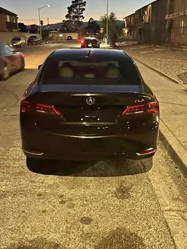 2017 Acura TLX Technology Package