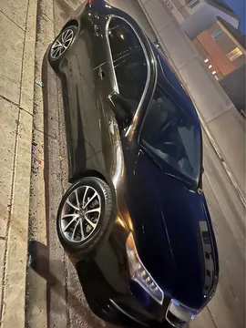 2017 Acura TLX Technology Package