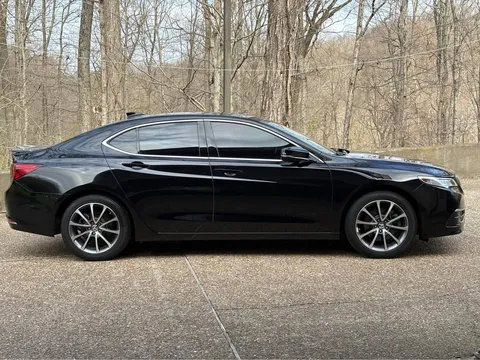 2017 Acura TLX 3.5 Technology Package