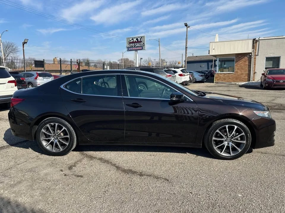2017 Acura TLX 1st Gen - Image 4 of 20