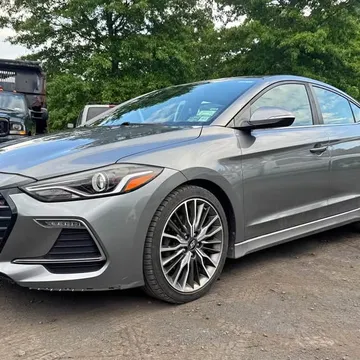 2017 Hyundai Elantra Sport Sedan