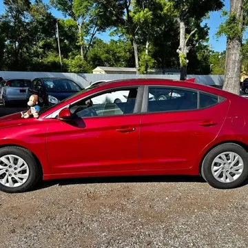 2017 Hyundai SE Sedan 4 Door