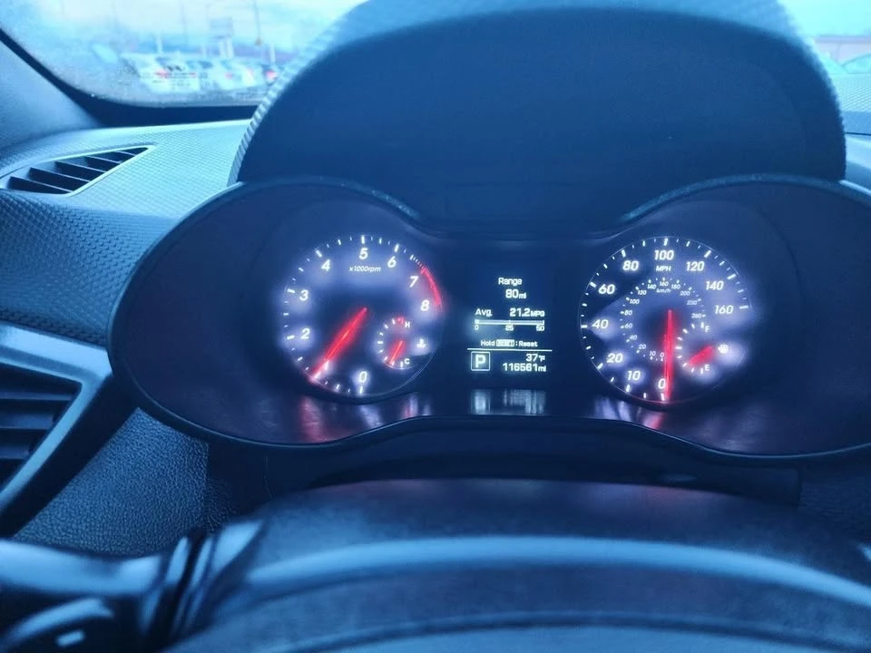 2017 Hyundai Veloster - Image 11 of 20