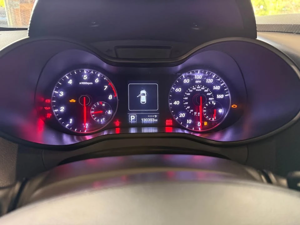2017 Hyundai Veloster - Image 8 of 10