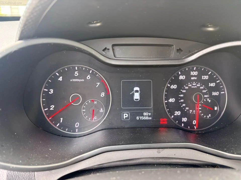 2017 Hyundai Veloster - Image 5 of 14