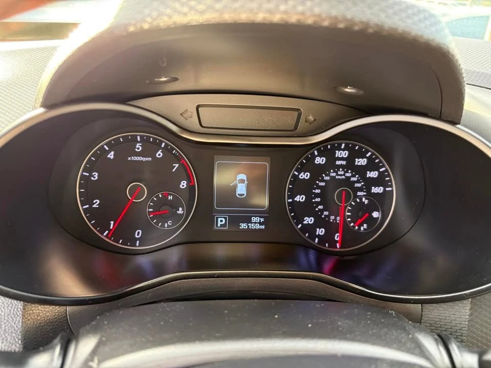 2017 Hyundai Veloster - Image 20 of 20