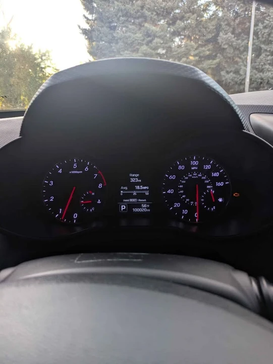 2017 Hyundai Veloster - Image 10 of 11