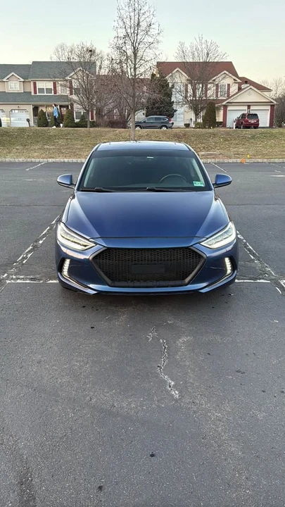 2017 Hyundai Elantra - Image 2 of 20