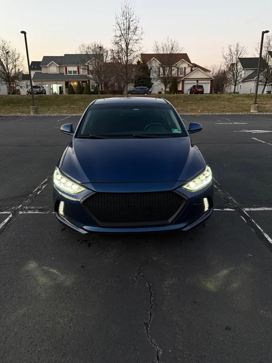2017 Hyundai Elantra - Image 3 of 20