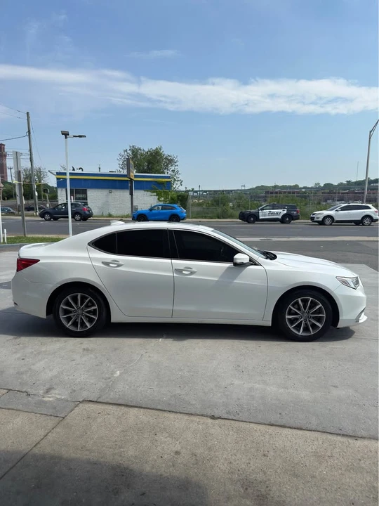 2018 Acura TLX 1st Gen - Image 5 of 10