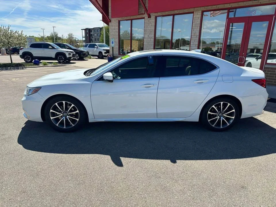 2018 Acura TLX 1st Gen - Image 4 of 7