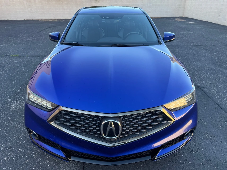 2018 Acura TLX 1st Gen - Image 3 of 21