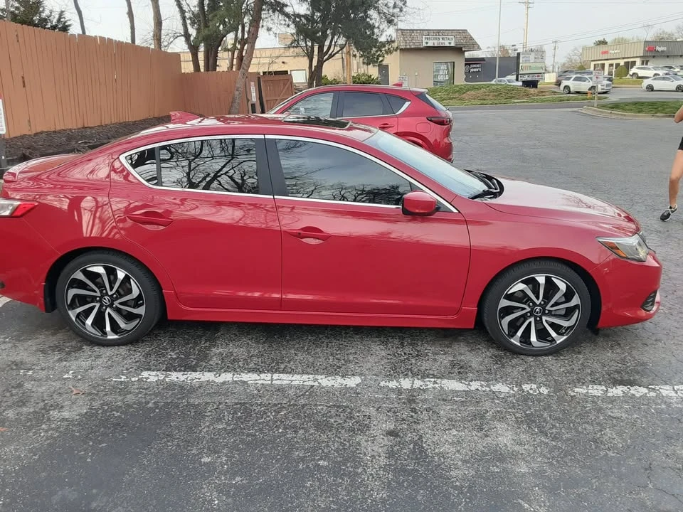 2018 Acura ILX - Image 2 of 10