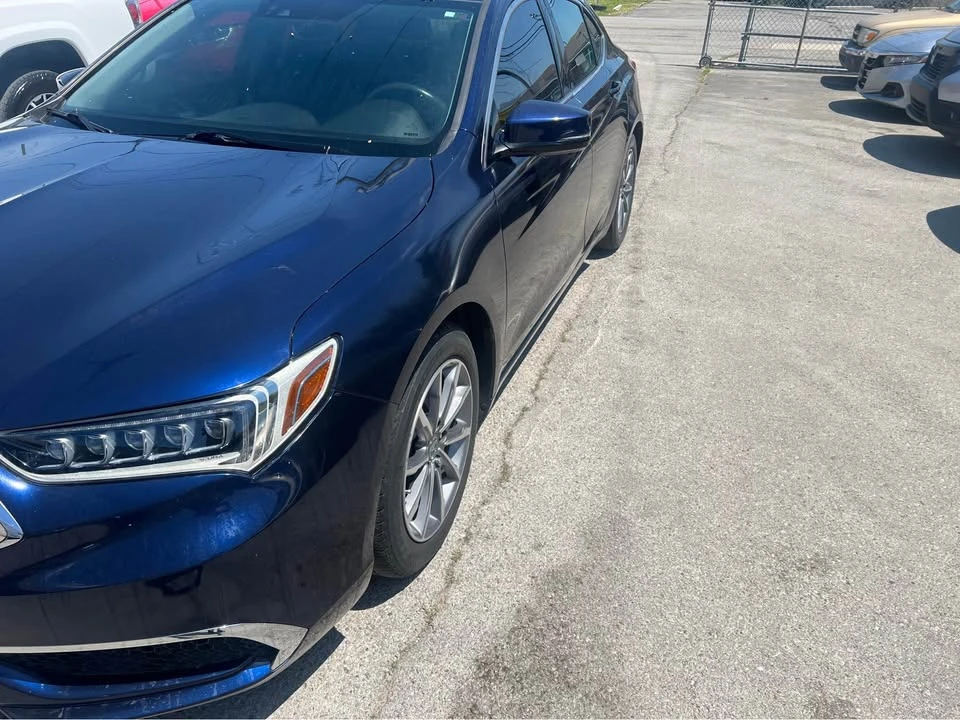 2018 Acura TLX 1st Gen - Image 2 of 11