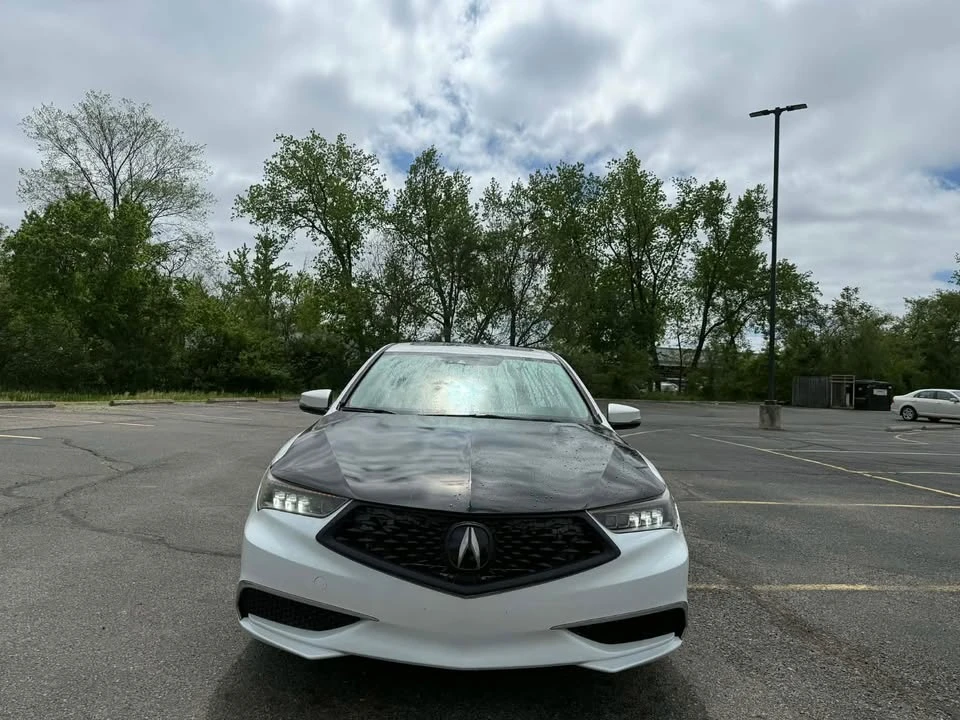 2018 Acura TLX 1st Gen - Image 3 of 17