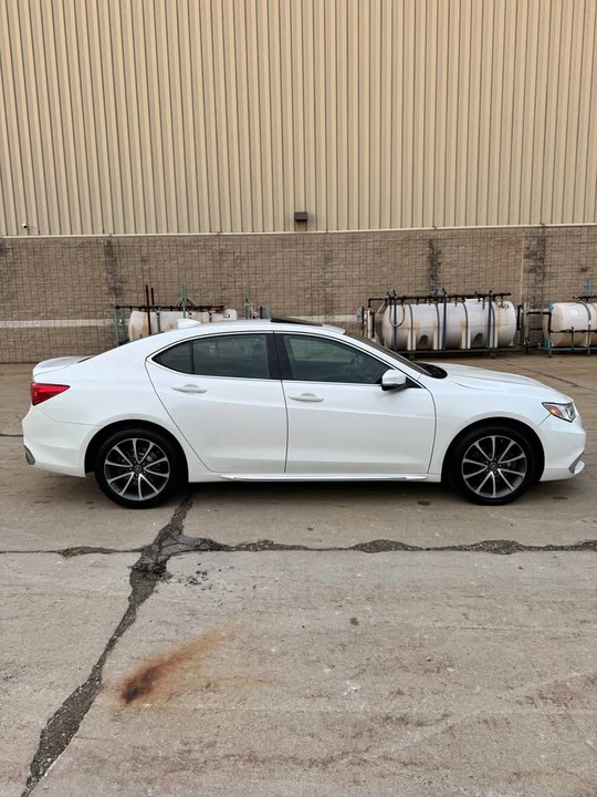 2018 Acura TLX 2nd Gen - Image 3 of 20