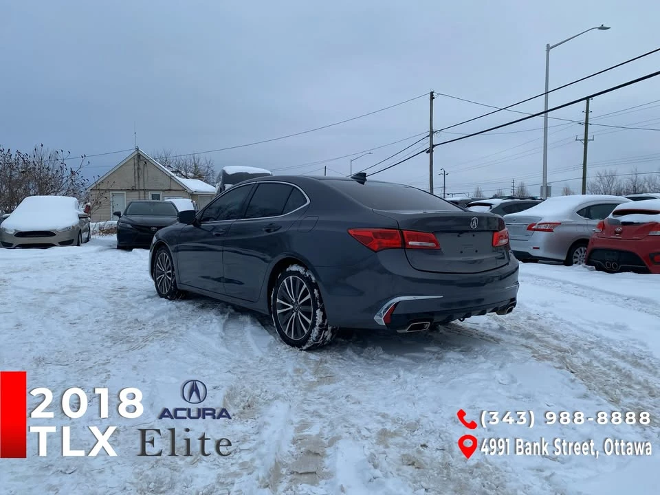 2018 Acura TLX 1st Gen - Image 3 of 16