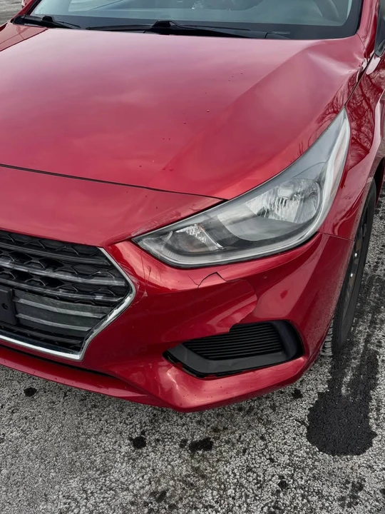 2018 Hyundai Accent - Image 10 of 10