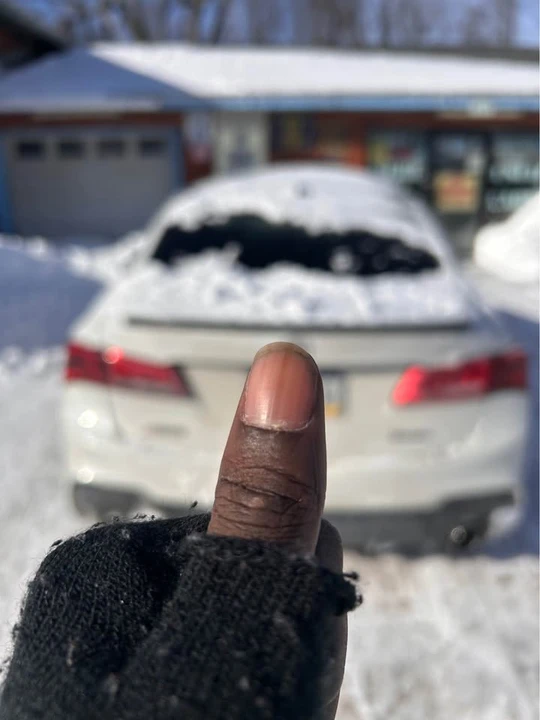 2019 Acura TLX 2nd Gen - Image 3 of 13