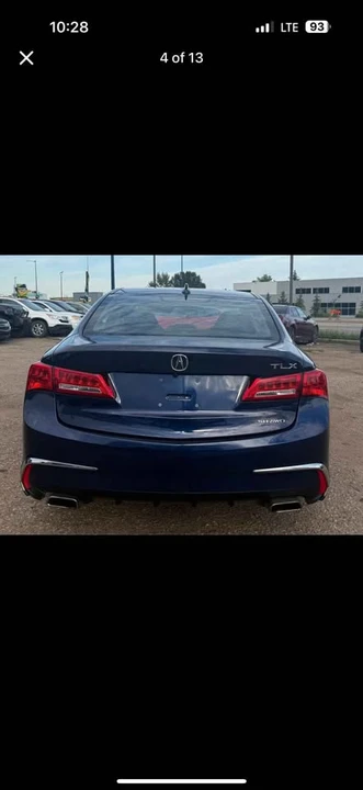 2019 Acura TLX 2nd Gen - Image 3 of 7