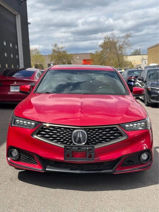 2019 Acura TLX 1st Gen - Image 2 of 11