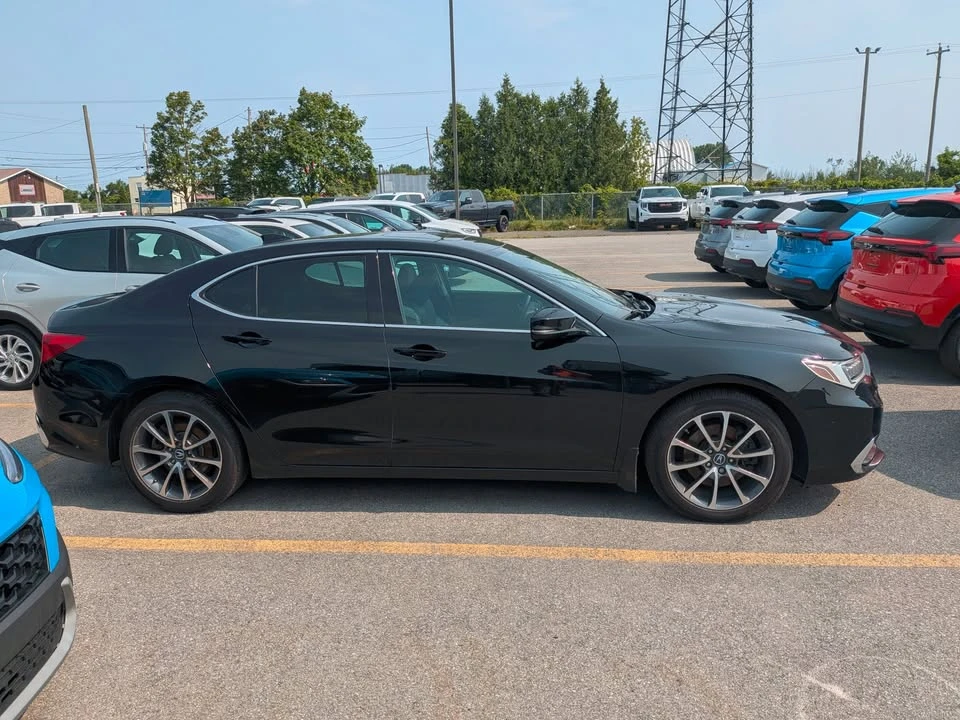 2019 Acura TLX 1st Gen - Image 4 of 18