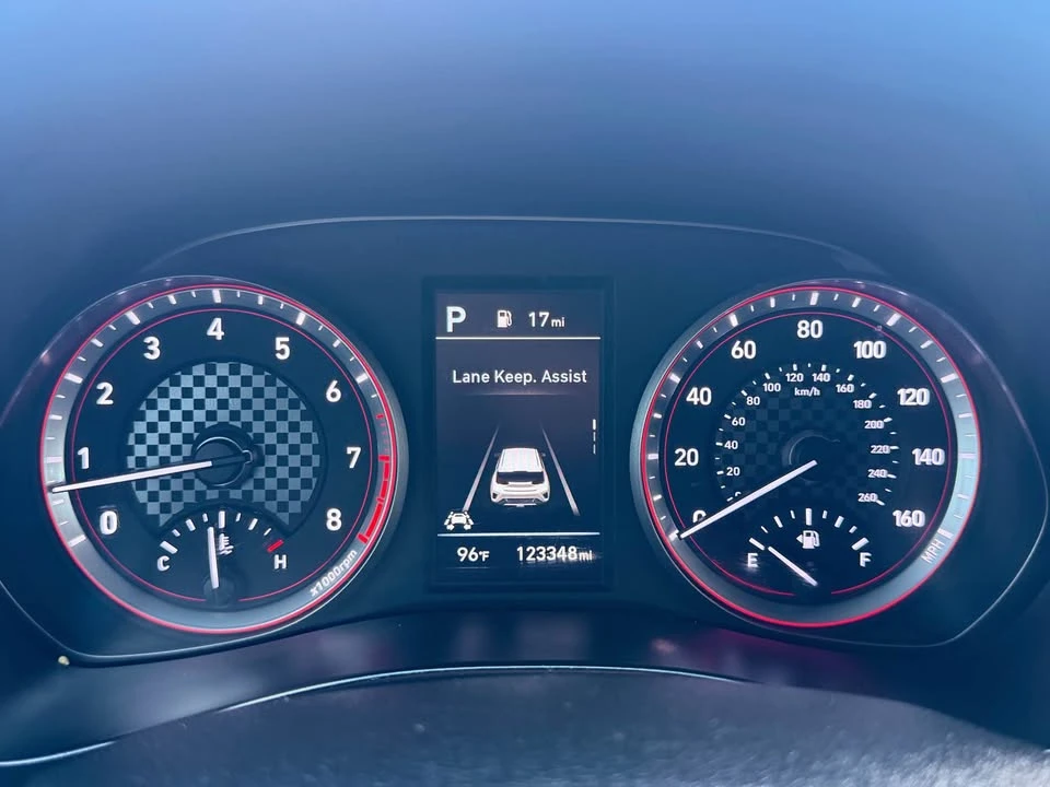 2020 Hyundai Veloster - Image 20 of 20