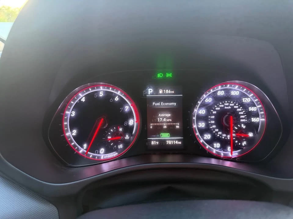 2020 Hyundai Veloster - Image 13 of 17