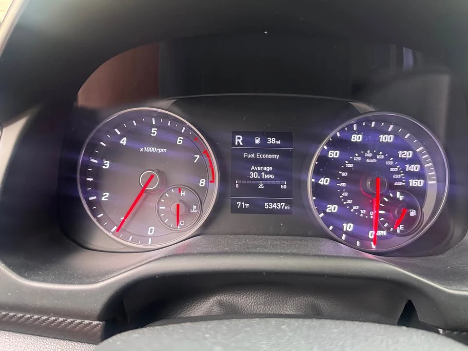 2020 Hyundai Elantra - Image 6 of 9