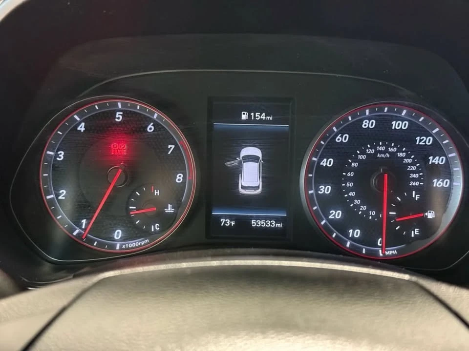 2021 Hyundai Veloster - Image 17 of 20